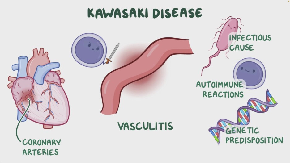 Kawasaki Disease Awareness Day
